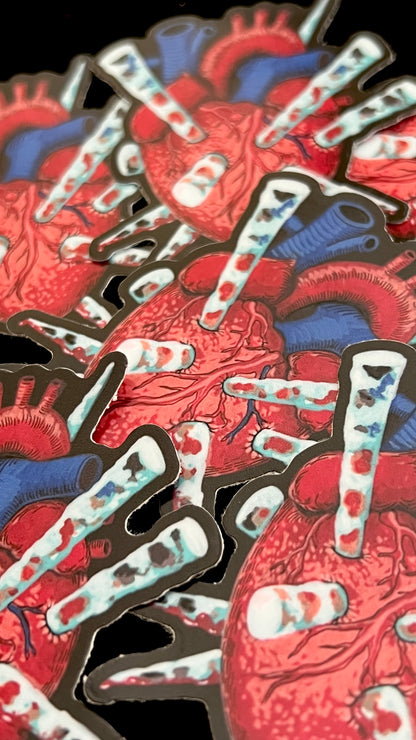 Overkill sticker